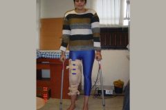 Sonika Kaliraman treated for by Dr. Prateek
