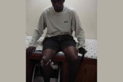 Ace Footballer ADDY meniscus surgery by Dr. Prateek